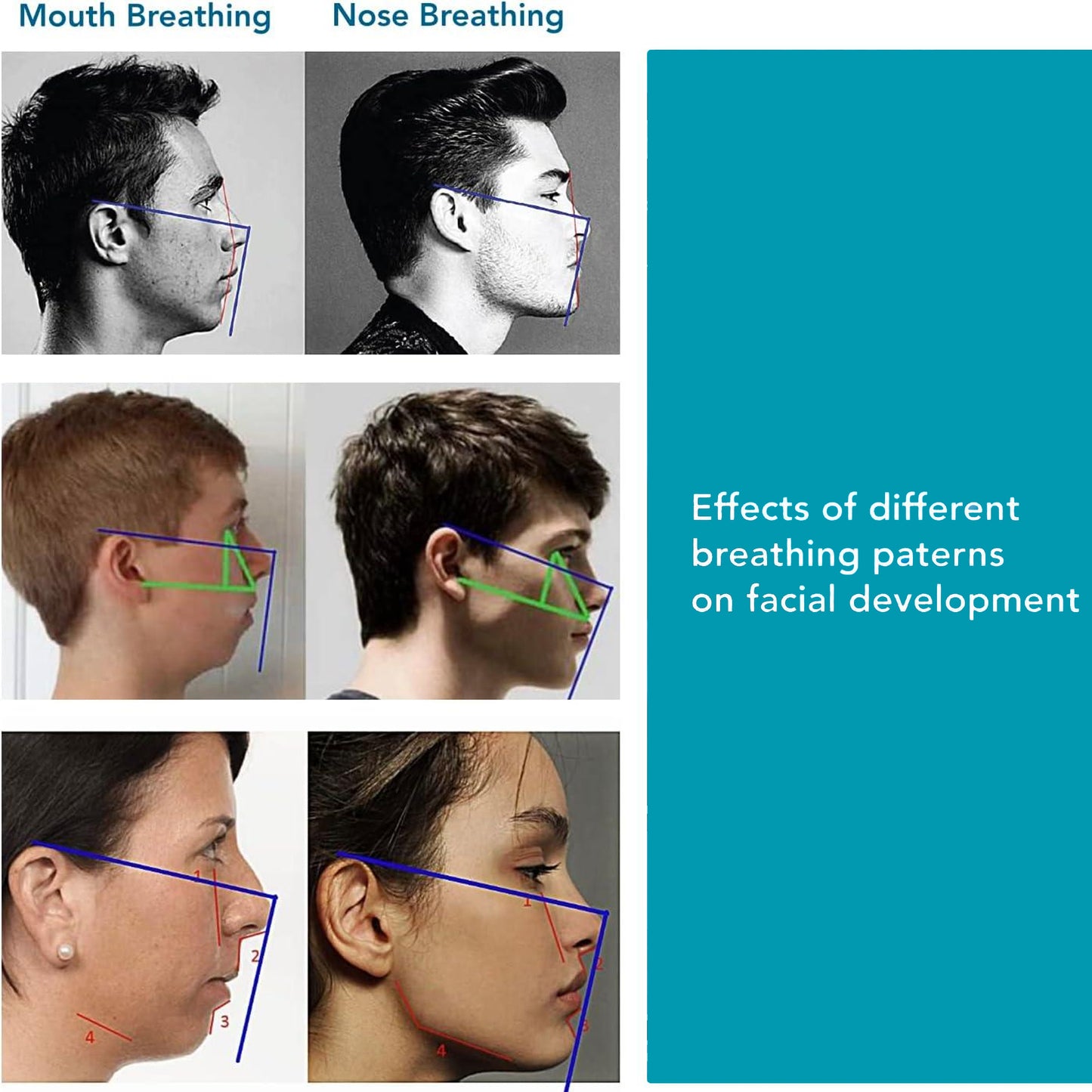 Mouth Tape for Snoring, CPAP, Sleep Apnea & Mouth Breathers.