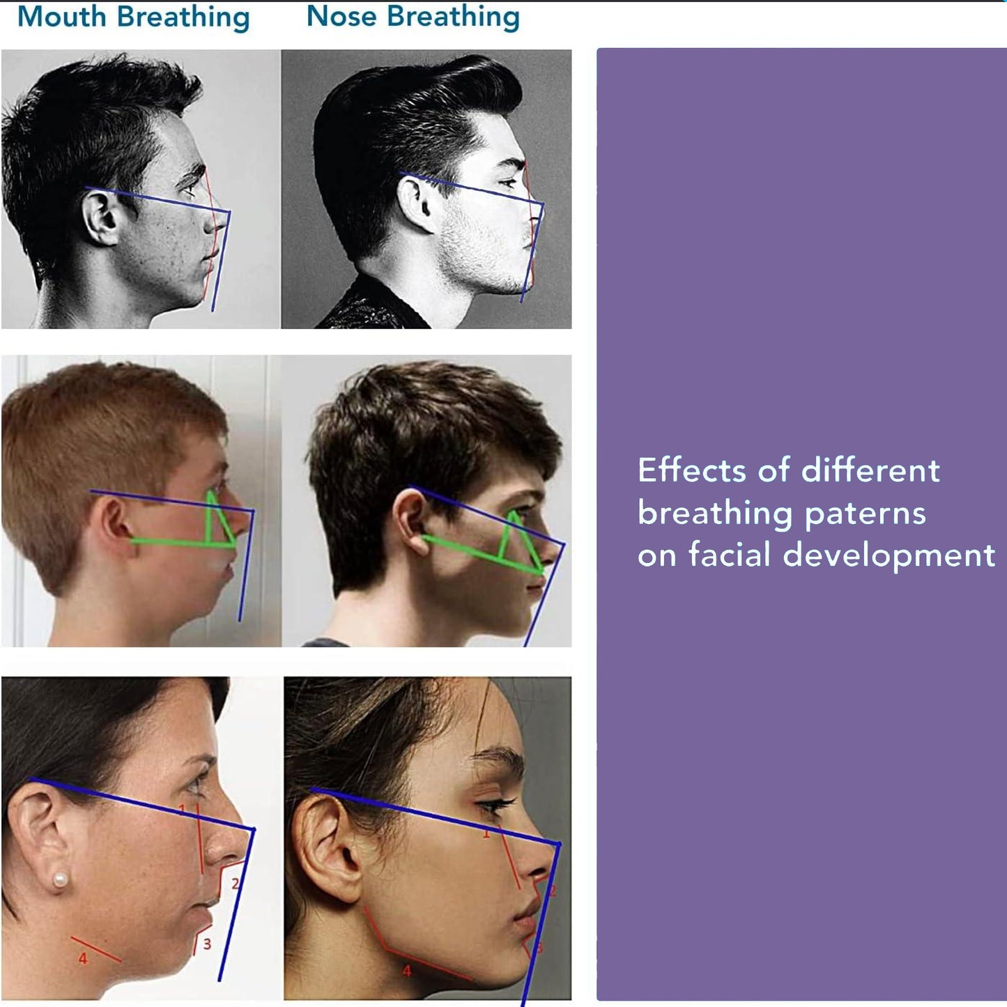 Lavender Scented Mouth Tape For Snoring & Sleep Apnea